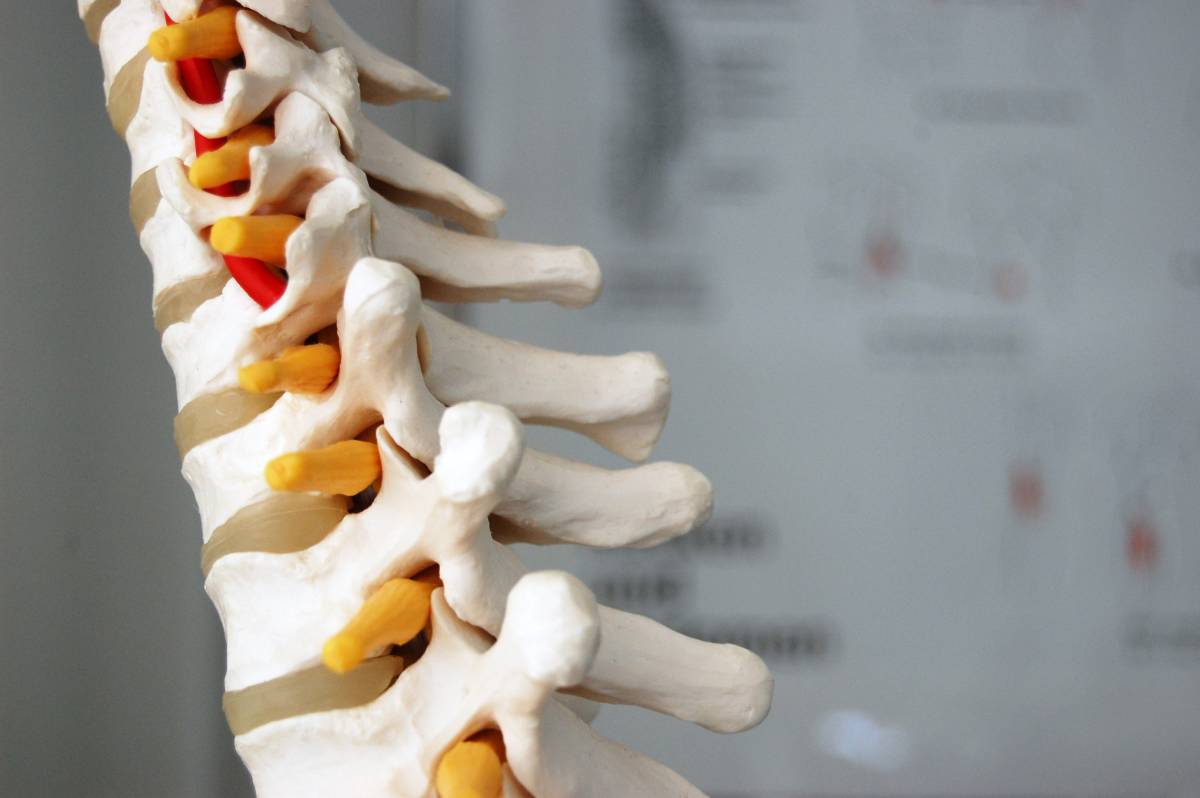 Disc Disease - The BodyFix - Mt. Pleasant Sports Medicine Chiropractic ...